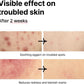 PINKWONDER Tamanu Hero Mineral Salt Essence Toner | All-in-One Blemish Solution | Instant Cooling & Redness Relief | Tamanu Oil & 70+ Minerals for Skin Balance (150ml / 5.07 fl. oz.)