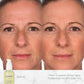 NassifMD Hydro-Screen Hydrating Serum with Hyaluronic Acid & Ceramides – Lightweight, Fast-Absorbing Formula for Smooth, Plump, Moisturized Skin – Ideal for Dry or Sensitive Skin