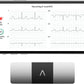 KardiaMobile 6-Lead Personal EKG Monitor – Six Views of The Heart – Detects AFib and Irregular Arrhythmias – Instant Results in 30 Seconds – Works with Most Smartphones