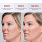 JMOON NouvelleSkin Facial Toning Device, FDA-Cleared Microcurrent Facial Device and Red Light Therapy for Face, 4 Modes & 5 Intensity Levels for Personalized Face Lift & Smoothing. M30U PR