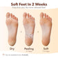 Purederm Exfoliating Foot Mask (3 Pack) – Regular Size Exfoliating Foot Masks for Cracked Feet, Dry Skin, Callused Feet…