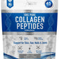The Intelligent Health Collagen Peptides Powder, 45 Servings, Hydrolyzed Collagen, Type I & III, Grass Fed, Unflavored, Gluten Free, Keto/Paleo, 10g Servings, 15.9 Oz, Skin Support, Hair, Nail, Joints