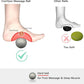 Hard Lacrosse Ball + Soft Peanut Massage Ball Set – Deep Tissue & Trigger Point Tool for Plantar Fasciitis Relief, QL, Iliacus, Glutes, Neck, Hamstrings, Hip Flexors & Myofascial Release
