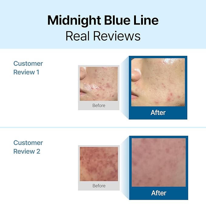 DearKlairs Midnight Blue Calming Cream – Soothing Face Moisturizer for Oily & Sensitive Skin, Redness Relief & Hydrating, Lightweight Texture, 2 Fl Oz