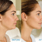 Stylia MaxiLift V-Line Lifting Collagen Face Mask – Enhanced Double Chin Reducer – Jawline Shaper Face Lifting Masks – Firming Neck Lift Collagen Mask – Chin Strap for Sleeping – Hyaluronic, Aloe 5PC