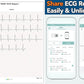 EMAY Portable ECG Monitor | Record ECG and Heart Rate | Compatible with Smartphone and PC