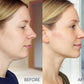 Stylia V Line Lifting Collagen Face Mask - Double Chin Strap for Women - Jawline Shaper Face Lift Tape - Neck Lift Collagen Mask - Chin Strap for Sleeping - Hyaluronic Acid, Aloe Vera, Cica 20PC
