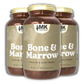 Bone & Marrow