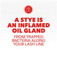 Stye Sterile Eye Ointment