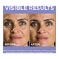 L'Oreal Derm Intensives Hyaluronic Acid Face Serum,